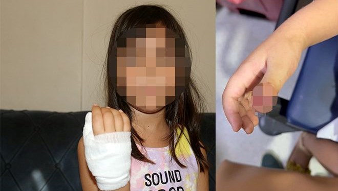 anaokulunda korkunc olay dort yasindaki cocugun parmagi koptu EtrntdGl